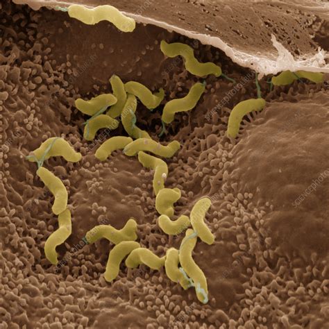 Lbumes Foto Como Eliminar De Ra Z La Bacteria Helicobacter Pylori