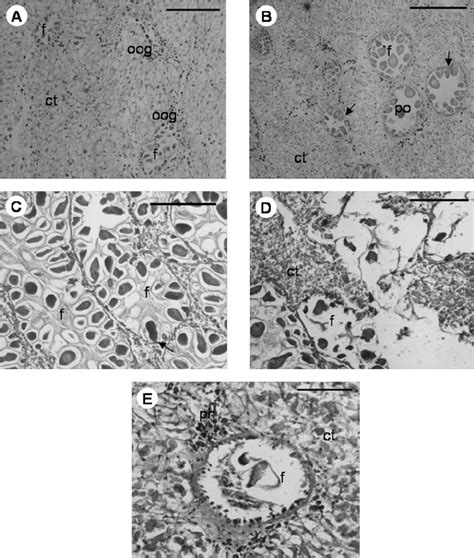 Photomicrographs Of Cross Sections Of Female Gonadal Tissue At