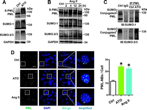 Effects Of Ato And Ang Ii On Pml Sumoylation And Pml Nbs Formation