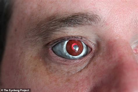 Eyeborg Filmmaker Has A Video Camera In His Prosthetic Eye That Can