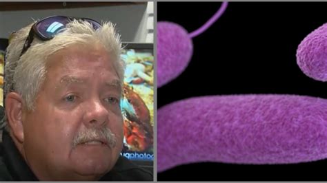 Md Survivor Of Flesh Eating Bacteria Speaks Out After Virginia