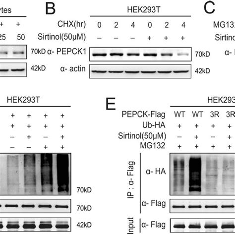 Sirtinol Induced Acetylation Promotes Pepck Degradation Via