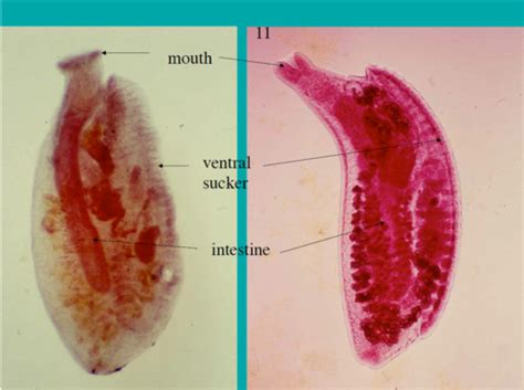 Parasitology Lab Practical Flashcards Quizlet