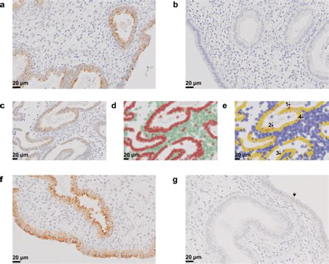 Immunohistochemistry Staining Of Endometrial Lamb A A Representative