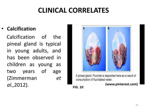 Embryology Of Pineal And Adrenal Gland By Zachariah Richard Ppt