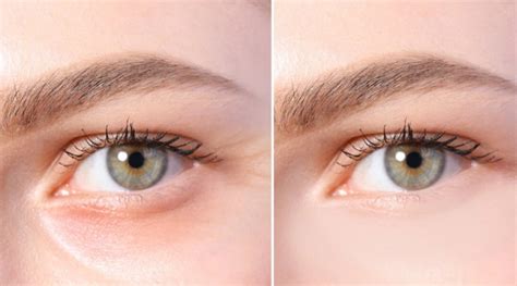 5 TIPS TO ELIMINATE EYE WRINKLES | theblogpost