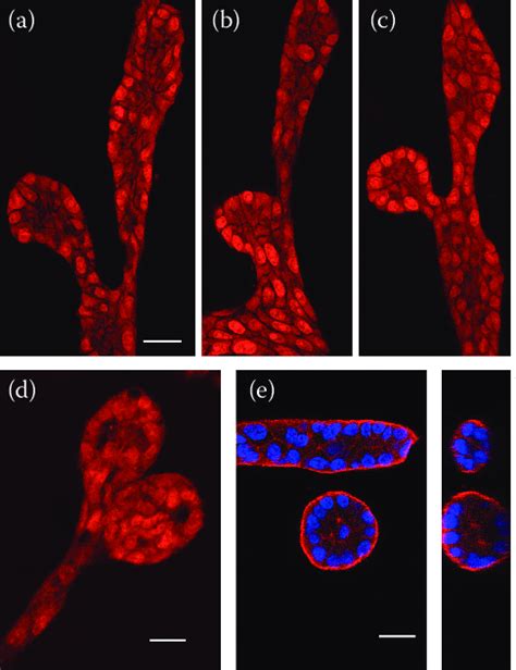 1 MCF10A Cells Grown In 3D Culture Conditions Mimic The Normal Breast