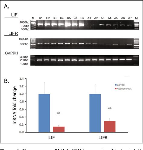 Figure 1 From Decreased Endometrial Expression Of Leukemia Inhibitory