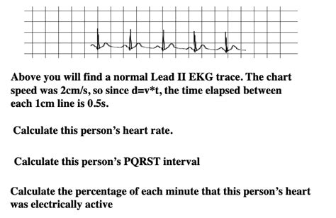 Solved Above you will find a normal Lead II EKG trace. The | Chegg.com