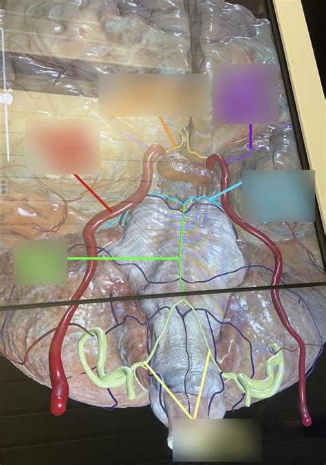Cranial Arterial Supply Diagram Quizlet