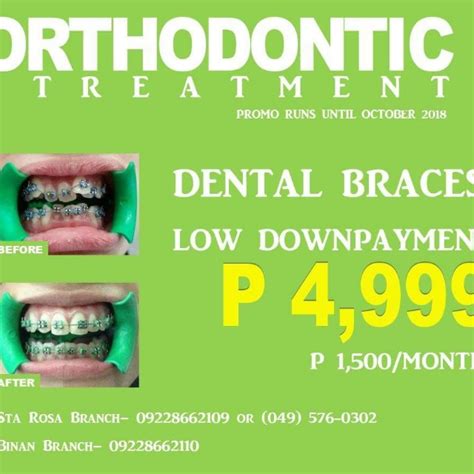 Affordable BRACES IN LAGUNA, Health & Nutrition, Assistive ...