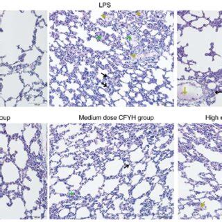 H E Staining Of Lung Tissues From The Sham LPS Dex Low Dose CFYH