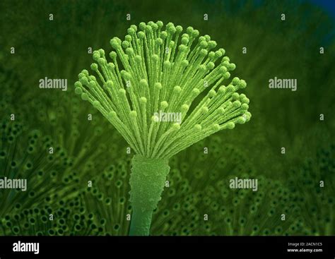 Aspergillus Fungus Computer Artwork Of The Fruiting Body Conidiophore