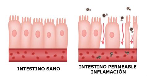 Permeabilidad Intestinal Vitamsana