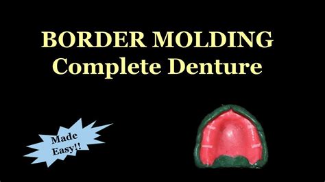 Border Molding Complete Denture Movements Youtube