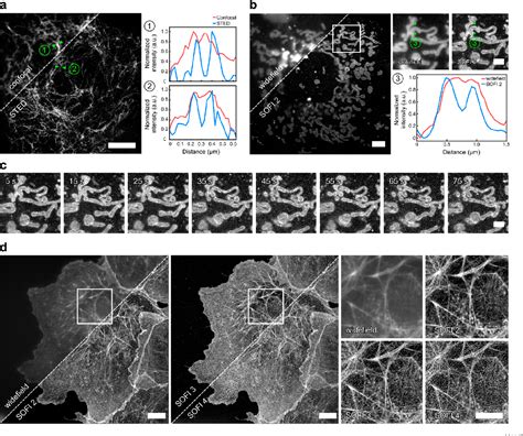 Figure 1 From University Of Birmingham Bio Orthogonal Red And Far Red