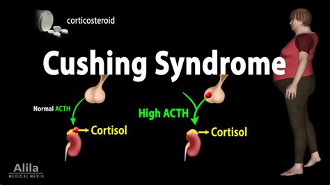 Cushing Syndrome Animation Youtube