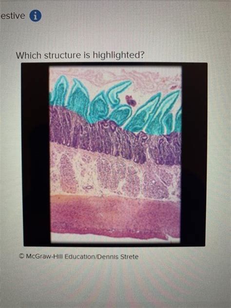 Solved Estive Which Structure Is Highlighted Multiple Chegg