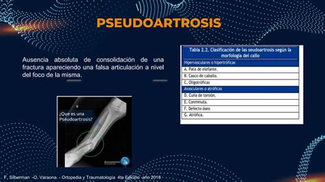 Fundamentos De La Traumatologia Pptx Ortopedia PPT