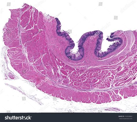 363 Imágenes De Esophagus Histology Imágenes Fotos Y Vectores De