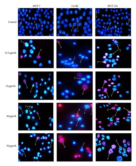 Representative Composite Images Show Morphological Changes Of Selected