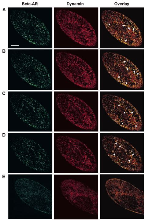 Localization Of Dynamin And Adrenergic Receptor Ar Immunoanalogue