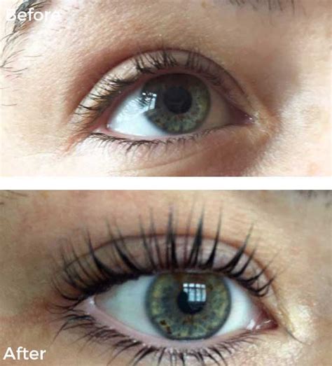 LVL Lashes (Carlisle) - Boost Your Natural Lashes | VL Aesthetics