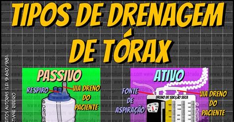 Os Tipos de Drenagem de Tórax