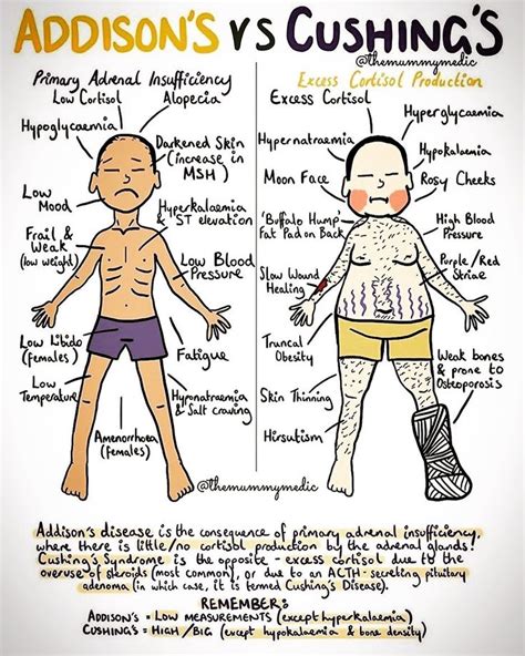 Usmlestep On Instagram Addisons Vs Cushings Usmlestep