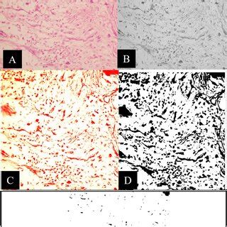 Representative Light Microscopic Photomicrographs H E 400 For The