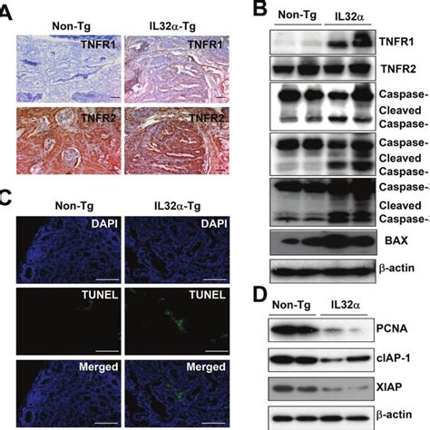 Expression of TNFR1 and cell in colon cancer tissues of IL 32α Tg