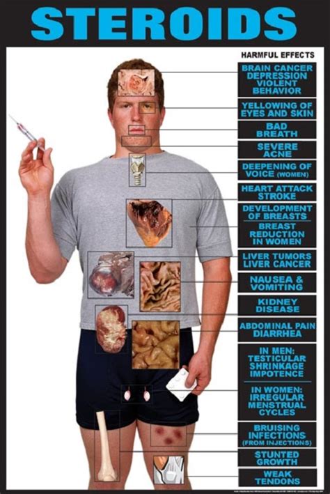 Difference Between Steroid And Testosterone Difference Between