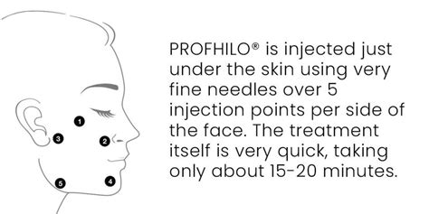 PROFHILO Treatment in Kuala Lumpur & Petaling Jaya. Complete Guide.