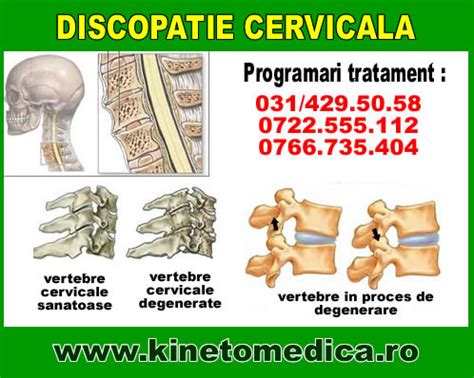 Discopatie Cervicala Tratament Centru Fizioterapie Sector Si