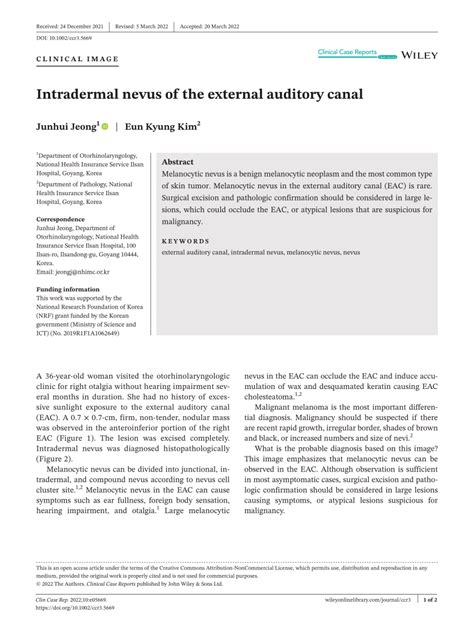 Pdf Intradermal Nevus Of The External Auditory Canal