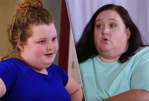 Honey Boo Boos Stepmom Has Weight Loss Surgery — Just Like Mama June