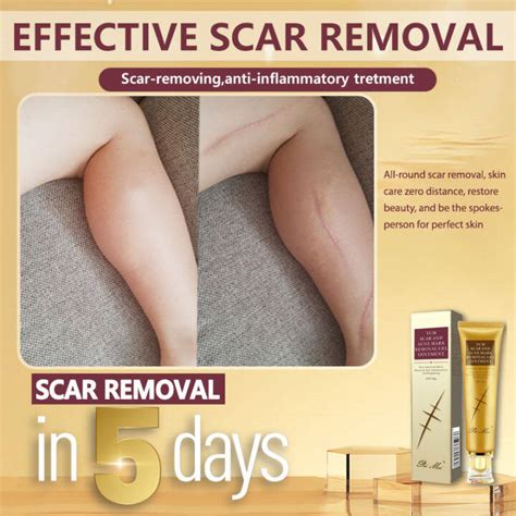 Scar Remover For Old Scar On Leg Removal Cream Strechmark Removal