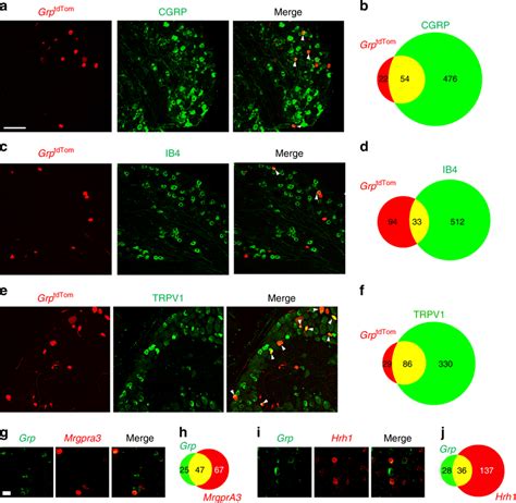 Grp Expression Is Enriched In A Subset Of Sensory Neurons With Both