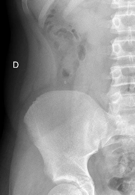 Pediatricrad Info Protocolos Radiolog A Pedi Trica