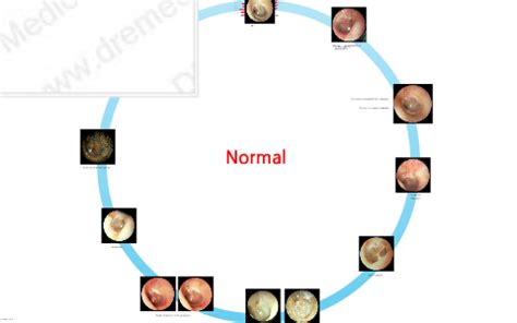 Otoscopy by 노 동현 on Prezi