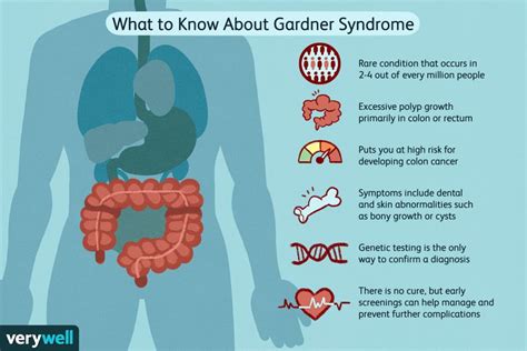 Gardner Syndrome: Symptoms, Treatment, and More