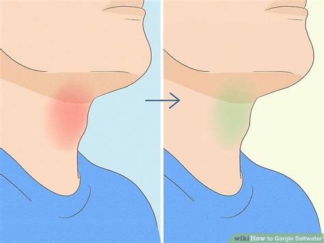 How To Gargle Saltwater For A Sore Throat Benefits And Tips