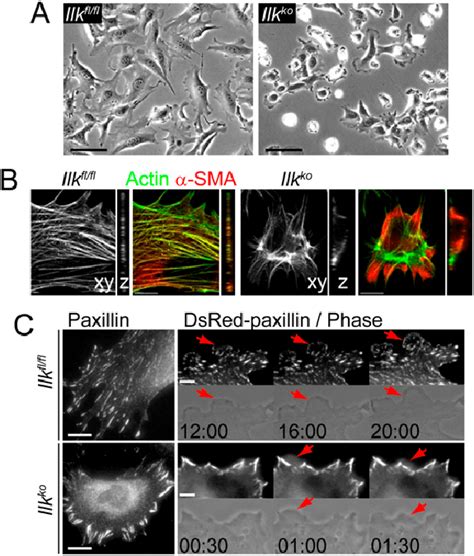 Loss Of Ilk Increases Cell Contractility And Changes Focal Adhesion