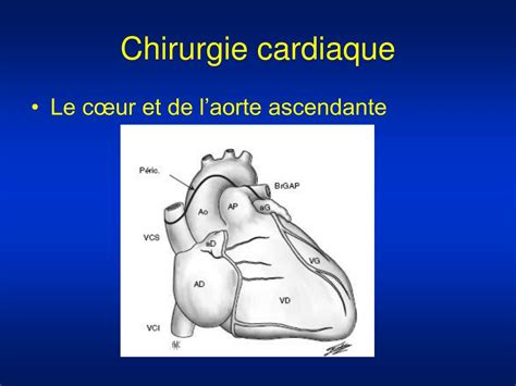 PPT La Chirurgie Cardiovasculaire PowerPoint Presentation Free