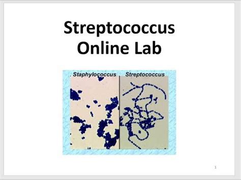 Streptococcus Lab YouTube