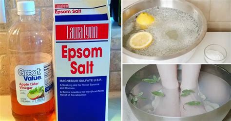 5 Simple Foot Soaks That Will Get Rid Of Smelly Feet Forever