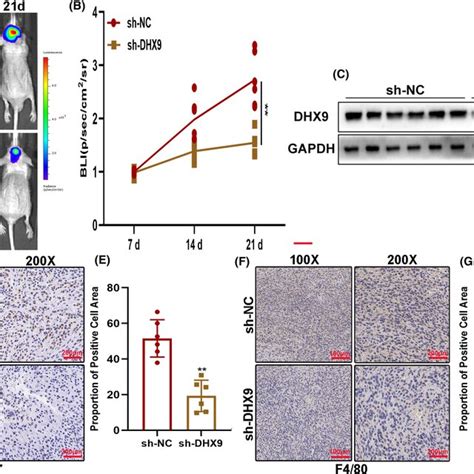 Dhx9 Knockdown Suppresses The Malignant Phenotype Of Gliomas In Vitro