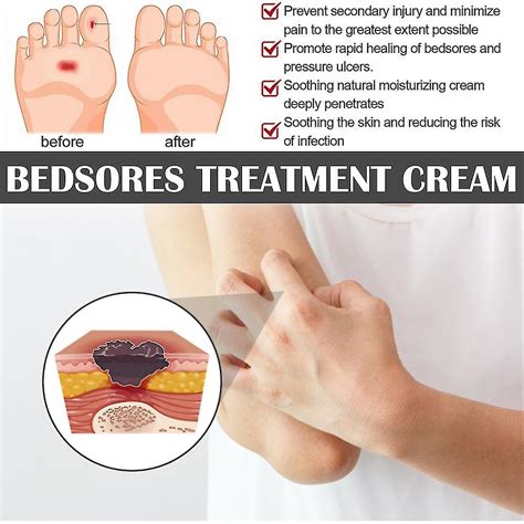 Bedsore Treatment Cream Pressure Sore Ulcer Skin Rot Necrotic Repair