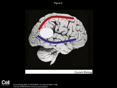 Cognitive Neurology Stimulating Research On Neglect Ppt Download