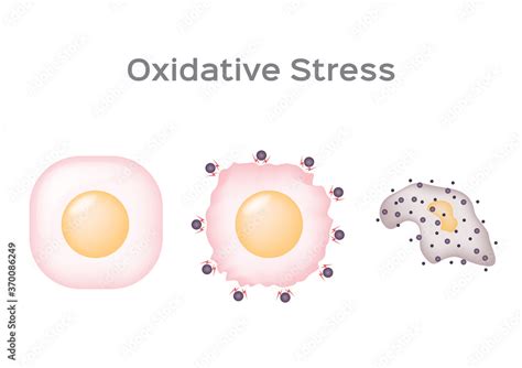 Oxidative Stress Cell Vector Free Radical Stock Vector Adobe Stock